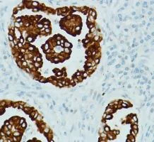 Immunohistochemistry (Formalin/PFA-fixed paraffin-embedded sections) - Anti-RRM1 antibody [SP167] - BSA and Azide free (AB240093)