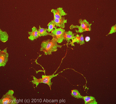 Immunocytochemistry/ Immunofluorescence - Anti-RRM2 antibody [1E1] (AB57653), expandable thumbnail