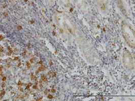 Immunohistochemistry (Formalin/PFA-fixed paraffin-embedded sections) - Anti-RRM2 antibody [1E1] (AB57653), expandable thumbnail