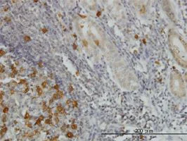 Immunohistochemistry (Formalin/PFA-fixed paraffin-embedded sections) - Anti-RRM2 antibody [1E1] (AB57653)