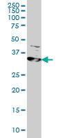 Western blot - Anti-RRM2 antibody [1E1] (AB57653), expandable thumbnail