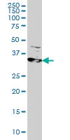Western blot - Anti-RRM2 antibody [1E1] (AB57653)