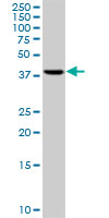 Western blot - Anti-RRM2 antibody [1E1] (AB57653), expandable thumbnail
