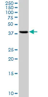 Western blot - Anti-RRM2 antibody [1E1] (AB57653)