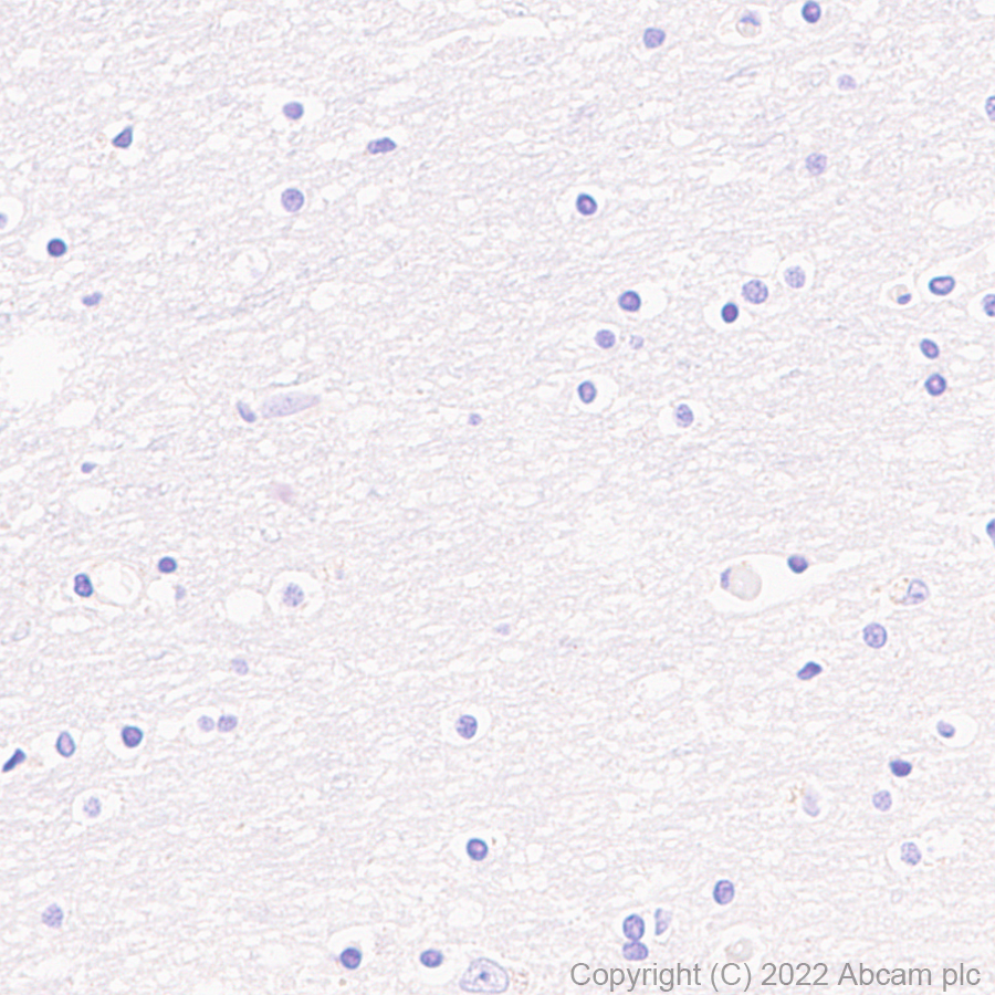 Immunohistochemistry (Formalin/PFA-fixed paraffin-embedded sections) - Anti-RRM2 antibody [EPR11820] (AB172476), expandable thumbnail