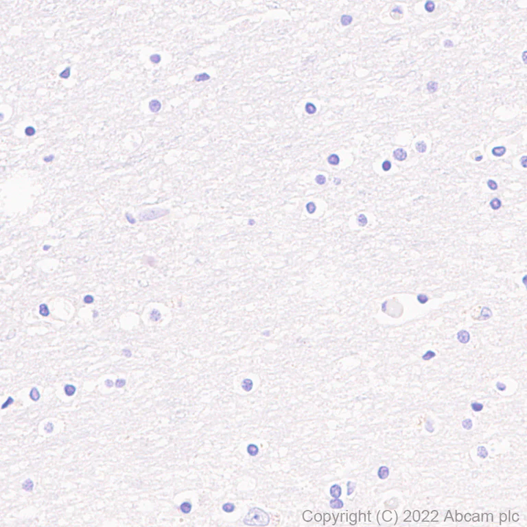 Immunohistochemistry (Formalin/PFA-fixed paraffin-embedded sections) - Anti-RRM2 antibody [EPR11820] (AB172476)