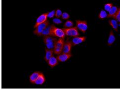 Immunocytochemistry/ Immunofluorescence - Anti-RRM2 antibody [EPR11820] - BSA and Azide free (AB240166), expandable thumbnail