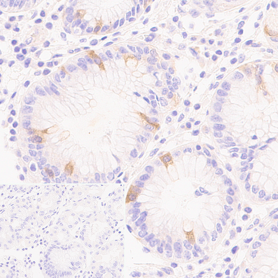 Immunohistochemistry (Formalin/PFA-fixed paraffin-embedded sections) - Anti-RRM2 antibody [EPR11820] - BSA and Azide free (ab240166), expandable thumbnail