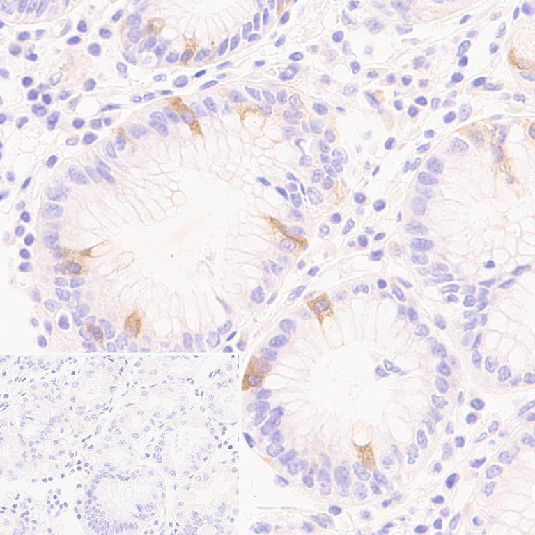 Immunohistochemistry (Formalin/PFA-fixed paraffin-embedded sections) - Anti-RRM2 antibody [EPR11820] - BSA and Azide free (AB240166)