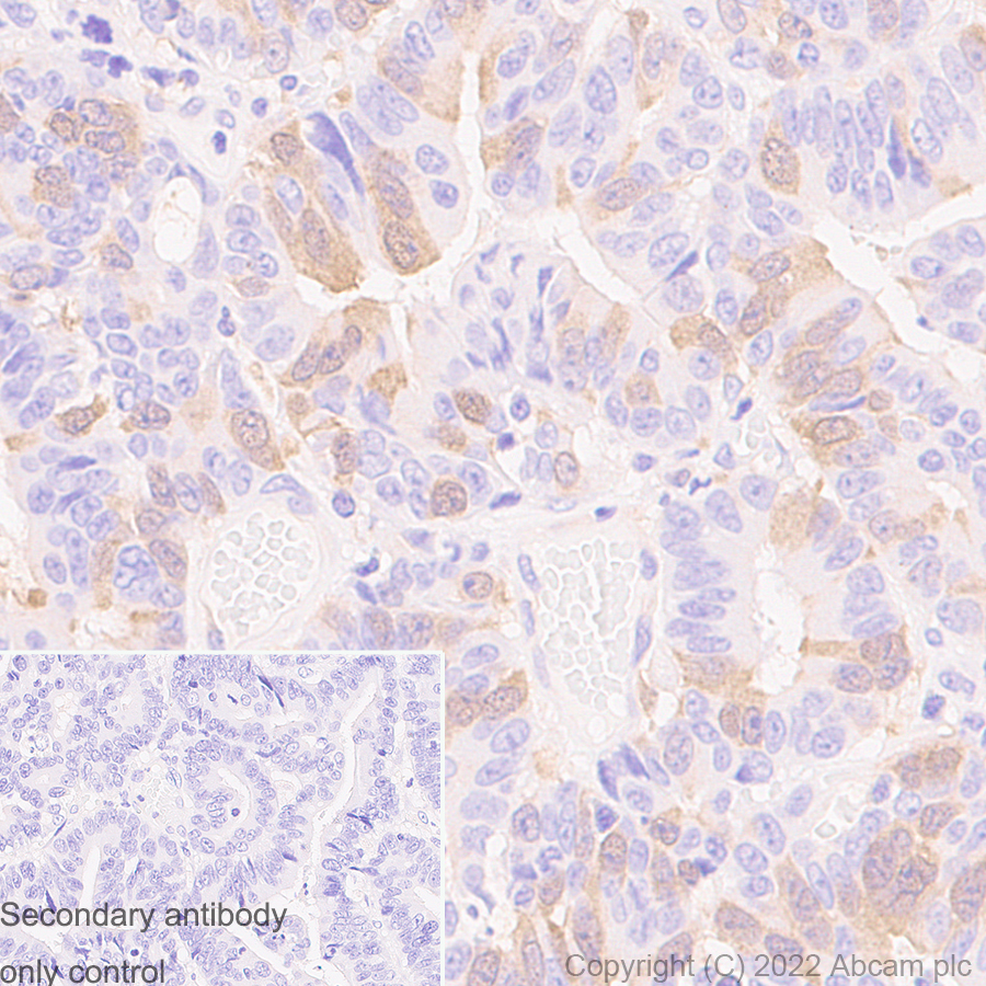 Immunohistochemistry (Formalin/PFA-fixed paraffin-embedded sections) - Anti-RRM2 antibody [EPR11820] - BSA and Azide free (AB240166), expandable thumbnail