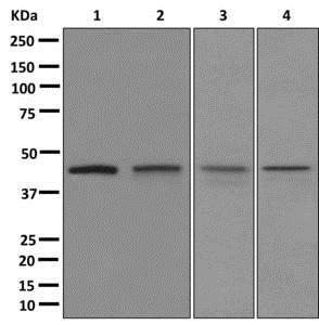Western blot - Anti-RRM2 antibody [EPR11820] - BSA and Azide free (AB240166), expandable thumbnail