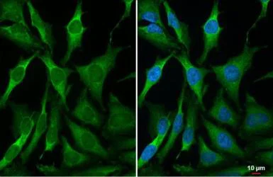 Immunocytochemistry/ Immunofluorescence - Anti-RRM2 antibody [HL1235] - BSA and Azide free (AB308351)