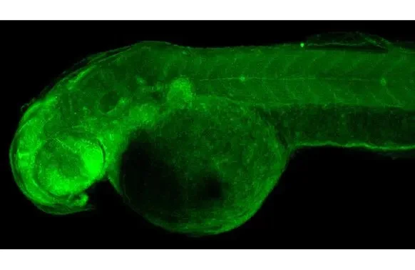 Immunohistochemistry (Formalin/PFA-fixed paraffin-embedded sections) - Anti-RRM2 antibody [HL1235] - BSA and Azide free (AB308351)