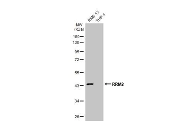 Western blot - Anti-RRM2 antibody [HL1235] - BSA and Azide free (AB308351)