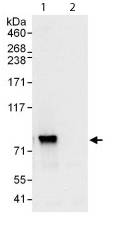Immunoprecipitation - Anti-RRN3 antibody (AB112052)