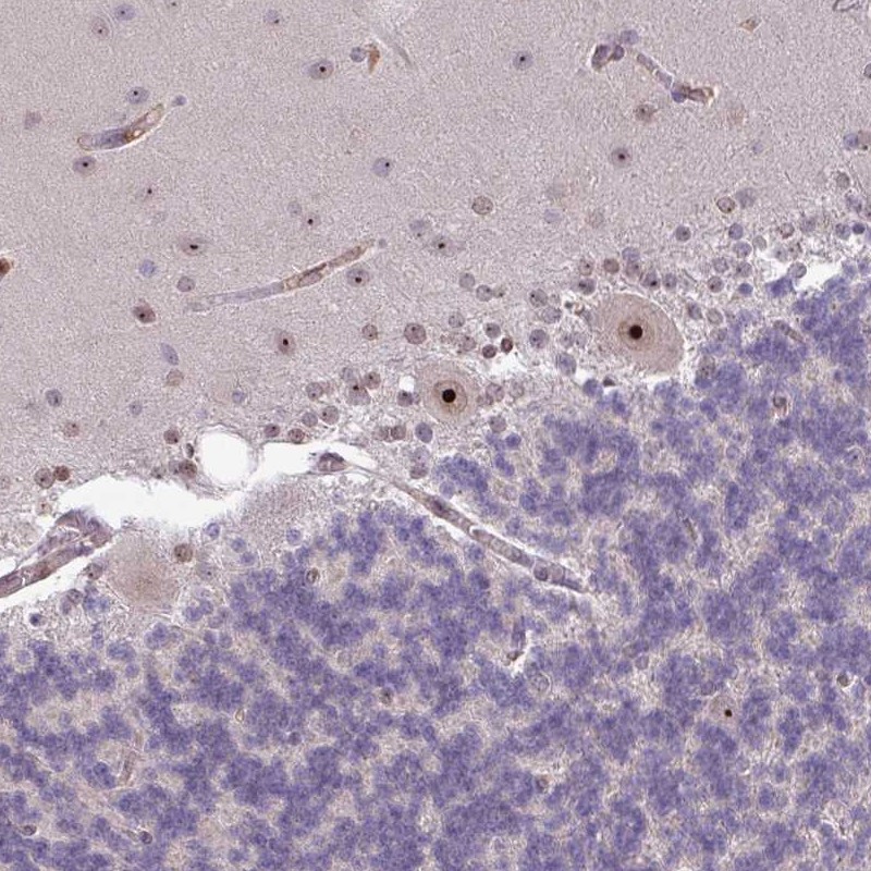 Immunohistochemistry (Formalin/PFA-fixed paraffin-embedded sections) - Anti-RRN3 antibody (AB251933), expandable thumbnail