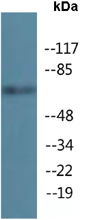 Western blot - Anti-RRN3 (phospho S649) antibody (AB138651)
