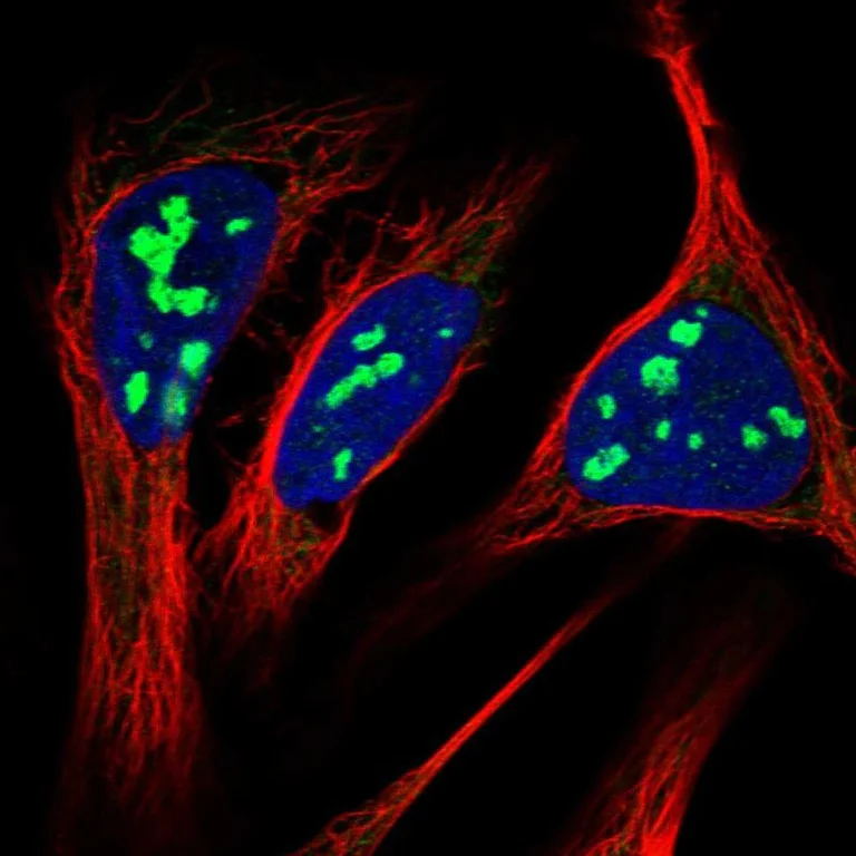 Immunocytochemistry/ Immunofluorescence - Anti-RRP15 antibody (AB121832)
