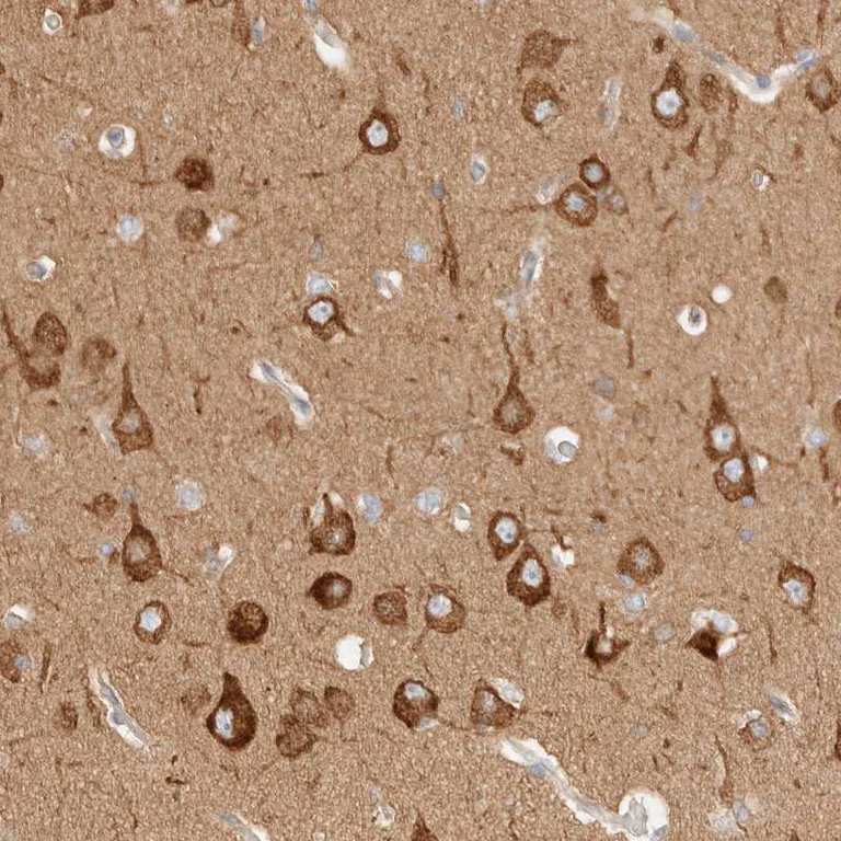 Immunohistochemistry (Formalin/PFA-fixed paraffin-embedded sections) - Anti-RRP15 antibody (AB121832)