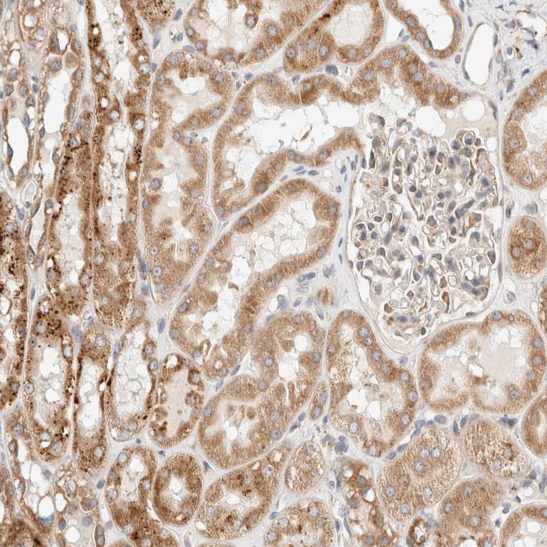 Immunohistochemistry (Formalin/PFA-fixed paraffin-embedded sections) - Anti-RRP15 antibody (AB121832)
