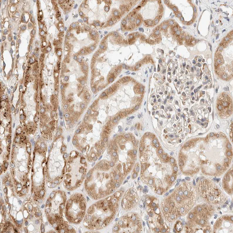 Immunohistochemistry (Formalin/PFA-fixed paraffin-embedded sections) - Anti-RRP15 antibody (AB121832)