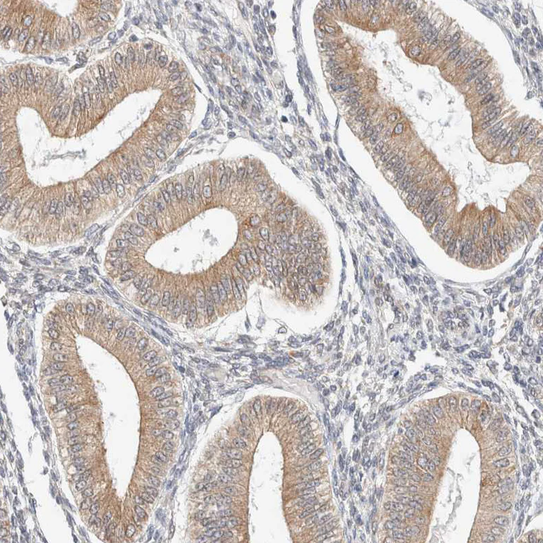 Immunohistochemistry (Formalin/PFA-fixed paraffin-embedded sections) - Anti-RRP15 antibody (AB121832)
