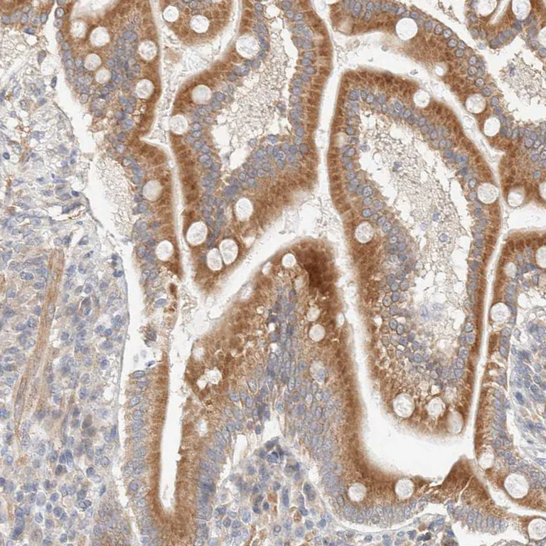 Immunohistochemistry (Formalin/PFA-fixed paraffin-embedded sections) - Anti-RRP15 antibody (AB121832)