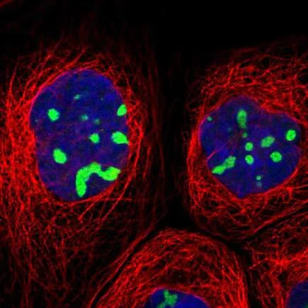 Immunocytochemistry/ Immunofluorescence - Anti-RRP1B antibody (AB224105)