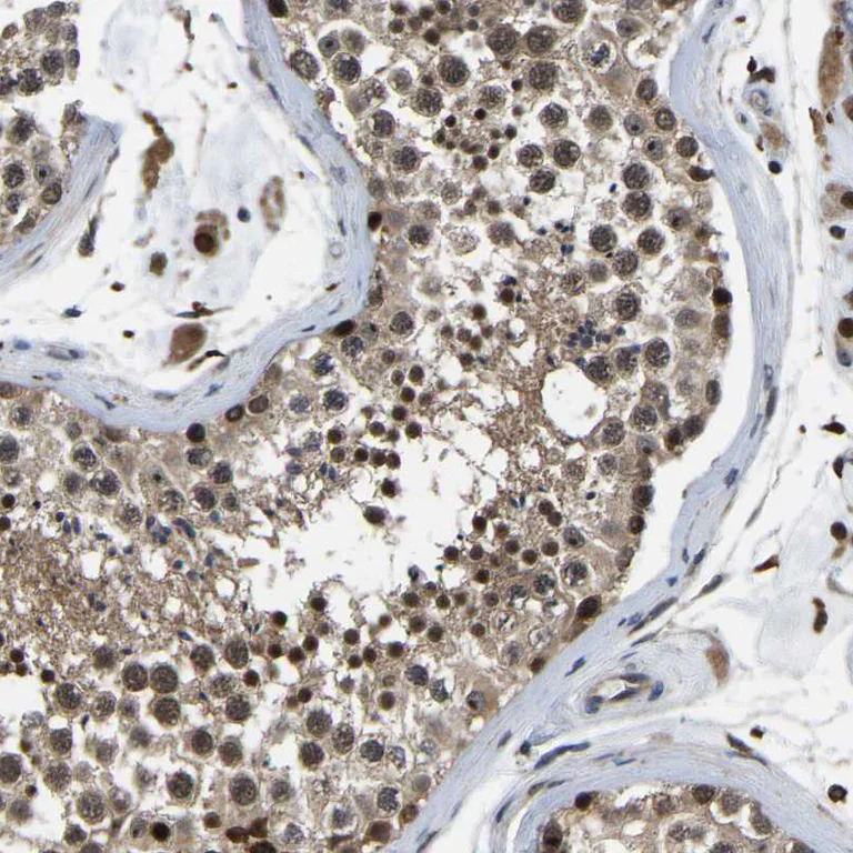 Immunohistochemistry (Formalin/PFA-fixed paraffin-embedded sections) - Anti-RRP1B antibody (AB224105)