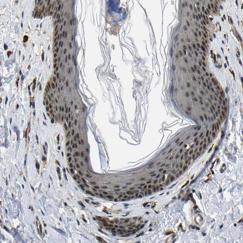 Immunohistochemistry (Formalin/PFA-fixed paraffin-embedded sections) - Anti-RRP1B antibody (AB224105)