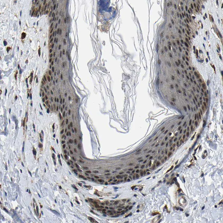 Immunohistochemistry (Formalin/PFA-fixed paraffin-embedded sections) - Anti-RRP1B antibody (AB224105)