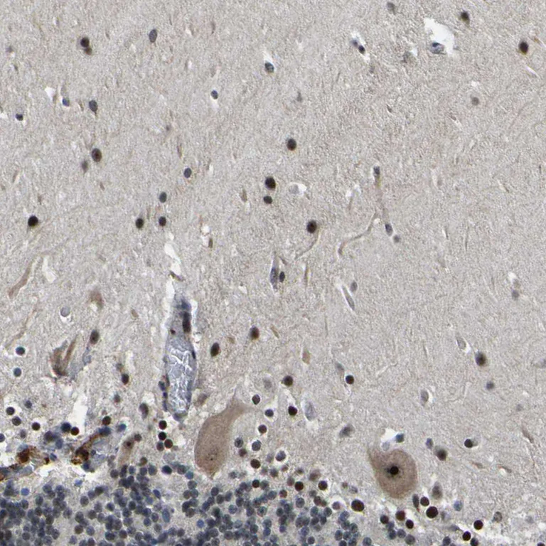 Immunohistochemistry (Formalin/PFA-fixed paraffin-embedded sections) - Anti-RRP1B antibody (AB224105)