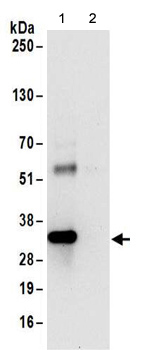 Immunoprecipitation - Anti-RRP4 antibody (AB156698)