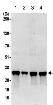 Western blot - Anti-RRP4 antibody (AB156698)