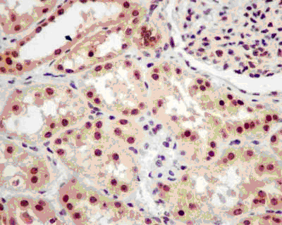 Immunohistochemistry (Formalin/PFA-fixed paraffin-embedded sections) - Anti-RRP4 antibody [EPR13605] - BSA and Azide free (AB250430)