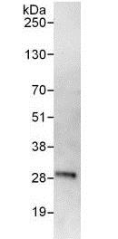Immunoprecipitation - Anti-RRP41 antibody (AB137250)