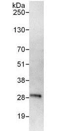 Immunoprecipitation - Anti-RRP41 antibody (AB137250)