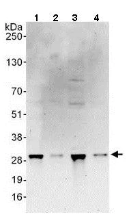 Western blot - Anti-RRP41 antibody (AB137250)