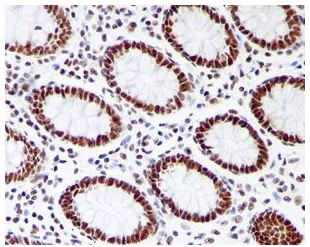 Immunohistochemistry (Formalin/PFA-fixed paraffin-embedded sections) - Anti-RRP42 antibody [EPR7452] (AB126750)