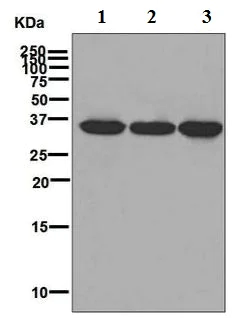 Western blot - Anti-RRP42 antibody [EPR7452] (AB126750)