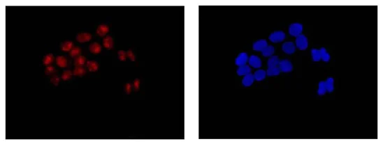 Immunocytochemistry/ Immunofluorescence - Anti-RRP7A antibody [EPR14412] - C-terminal (AB185225)