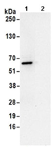 Immunoprecipitation - Anti-RRP9 antibody (AB168845)
