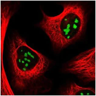 Immunocytochemistry/ Immunofluorescence - Anti-RRS1 antibody (AB188161)