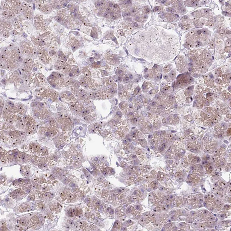 Immunohistochemistry (Formalin/PFA-fixed paraffin-embedded sections) - Anti-RRS1 antibody (AB188161)