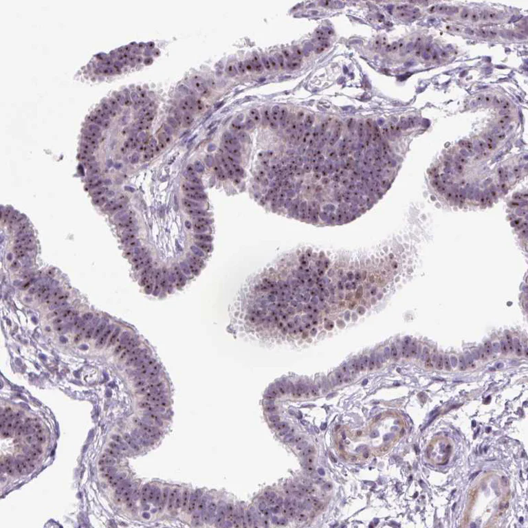 Immunohistochemistry (Formalin/PFA-fixed paraffin-embedded sections) - Anti-RRS1 antibody (AB188161)