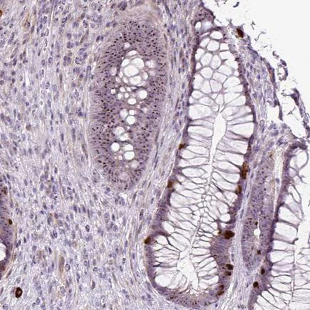 Immunohistochemistry (Formalin/PFA-fixed paraffin-embedded sections) - Anti-RRS1 antibody (AB188161)