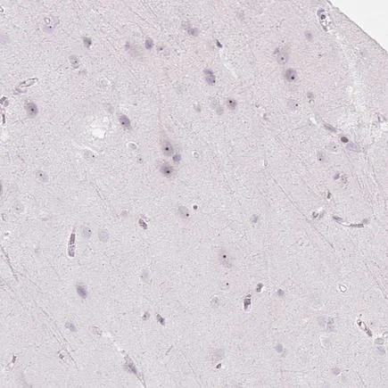 Immunohistochemistry (Formalin/PFA-fixed paraffin-embedded sections) - Anti-RRS1 antibody (AB188161)