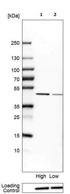 Western blot - Anti-RRS1 antibody (AB188161)