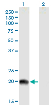 Western blot - Anti-RS1 antibody (AB167579)