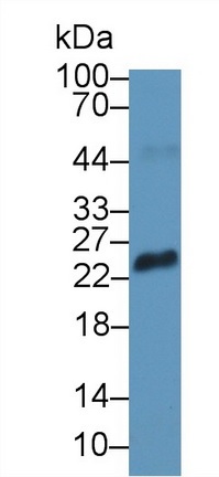 Western blot - Anti-RS1 antibody (AB233428)